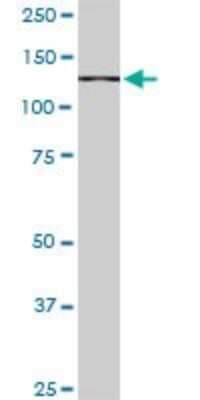 Western Blot: TIP120A Antibody (1G5) [H00055832-M05]