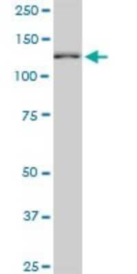 Western Blot: TIP120A Antibody (2D7) [H00055832-M03]