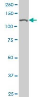 Western Blot: TIP120A Antibody (4D10) [H00055832-M04]