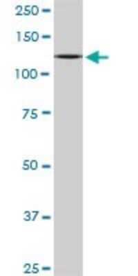 Western Blot: TIP120A Antibody (4D10) [H00055832-M04]