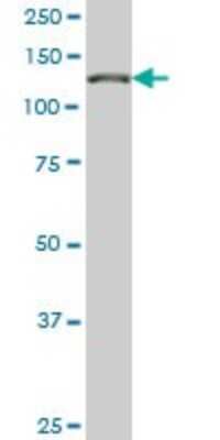 Western Blot: TIP120A Antibody (5F2) [H00055832-M02]