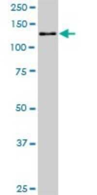 Western Blot: TIP120A Antibody (5F2) [H00055832-M02]