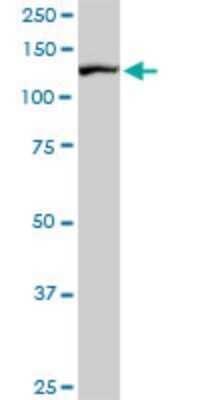 Western Blot: TIP120A Antibody (5F2) [H00055832-M02]