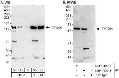 Western Blot: TIP120A Antibody [NBP1-49918]