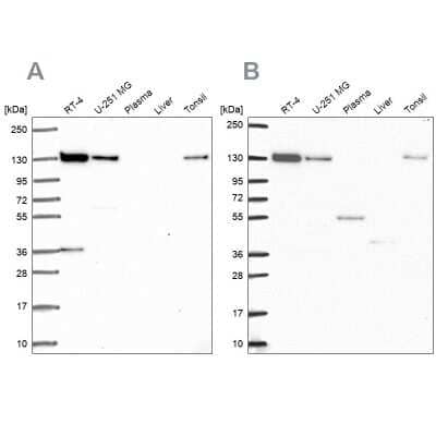 Western Blot: TIP120A Antibody [NBP2-38974]