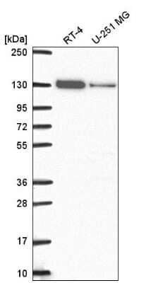 Western Blot: TIP120A Antibody [NBP2-55510]