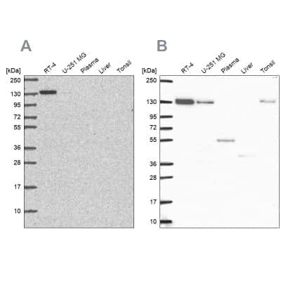 Western Blot: TIP120A Antibody [NBP2-56630]