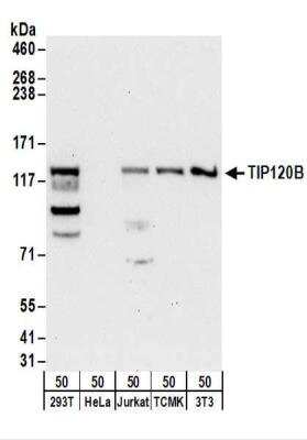 Western Blot: TIP120B Antibody [NBP2-22334]