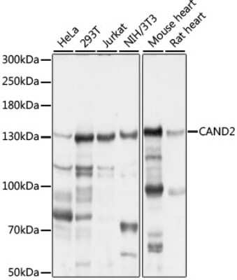 Western Blot: TIP120B AntibodyAzide and BSA Free [NBP2-94561]