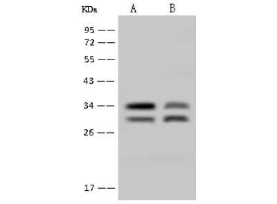 Immunohistochemistry: TIP30 Antibody [NBP2-98510]