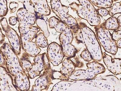 Immunohistochemistry-Paraffin: TIP30 Antibody [NBP2-98510]