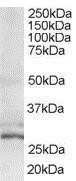 Western Blot: TIP30 Antibody [NB100-1415]