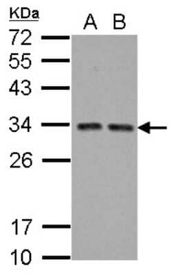 Western Blot: TIP30 Antibody [NBP2-20646]