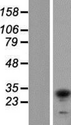 Western Blot: TIP30 Overexpression Lysate [NBP2-10414]