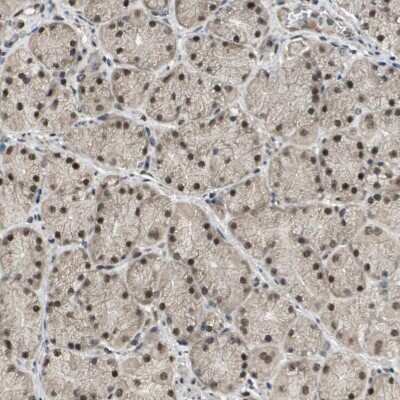 Immunohistochemistry-Paraffin: TIP60 Antibody [NBP1-85482]
