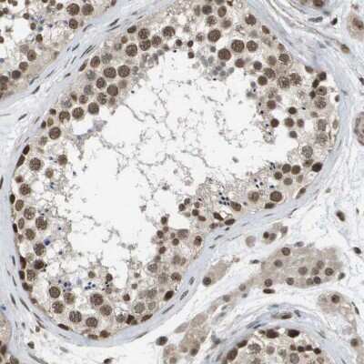 Immunohistochemistry-Paraffin: TIP60 Antibody [NBP1-85482]