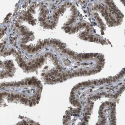 Immunohistochemistry-Paraffin: TIP60 Antibody [NBP1-85482]