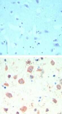 Immunohistochemistry-Paraffin: TIP60 Antibody [NBP2-24613]