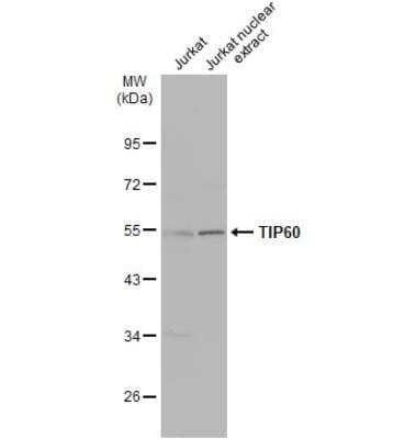 Western Blot: TIP60 Antibody [NBP2-20647]