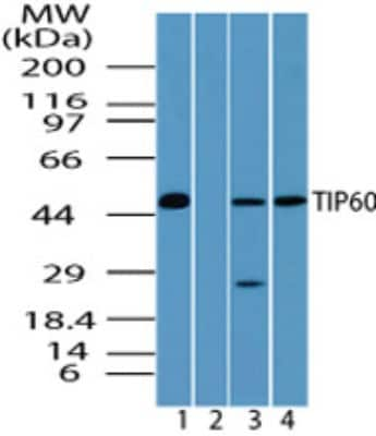 Western Blot: TIP60 Antibody [NBP2-24613]