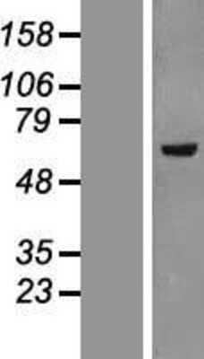 Western Blot: TIP60 Overexpression Lysate [NBL1-12126]