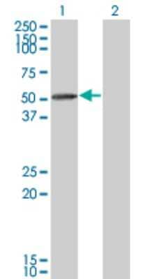 Western Blot: TIPIN Antibody (1G11) [H00054962-M01]