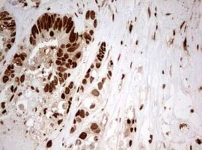 Immunohistochemistry: TIPIN Antibody (OTI2E6) [NBP2-46133]
