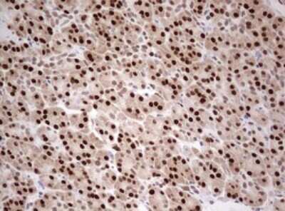 Immunohistochemistry: TIPIN Antibody (OTI2E6) [NBP2-46133]