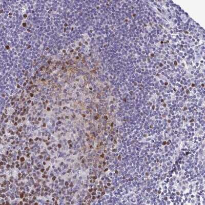 Immunohistochemistry: TIPIN Antibody [NBP2-38860]