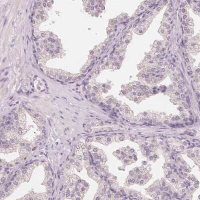 Immunohistochemistry-Paraffin: TIPIN Antibody [NBP1-83650]