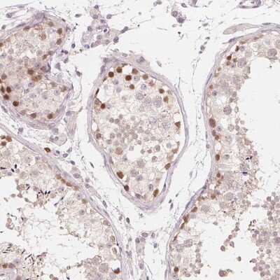 Immunohistochemistry-Paraffin: TIPIN Antibody [NBP1-83650]