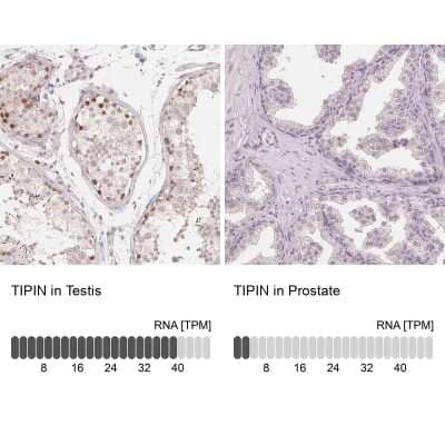 Immunohistochemistry-Paraffin: TIPIN Antibody [NBP1-83650]