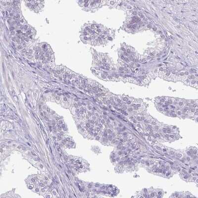 Immunohistochemistry-Paraffin: TIPIN Antibody [NBP2-38860]