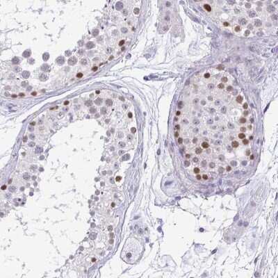 Immunohistochemistry-Paraffin: TIPIN Antibody [NBP2-38860]
