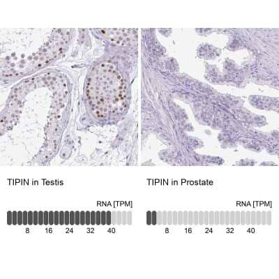 Immunohistochemistry-Paraffin: TIPIN Antibody [NBP2-38860]