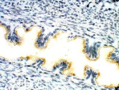 Immunohistochemistry-Paraffin: TIPIN Antibody [NBP3-12354]