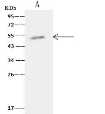 Immunoprecipitation: TIPIN Antibody [NBP2-98947]
