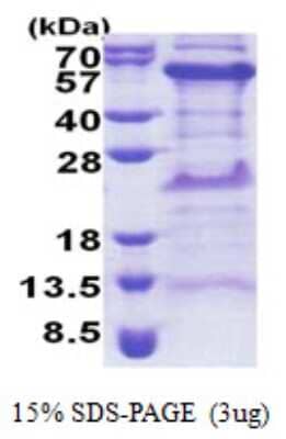 SDS-PAGE: Recombinant Human TIPIN His Protein [NBP2-22868]