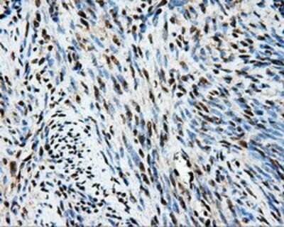 Immunohistochemistry-Paraffin: TIPRL Antibody (OTI3D11) [NBP2-02269]