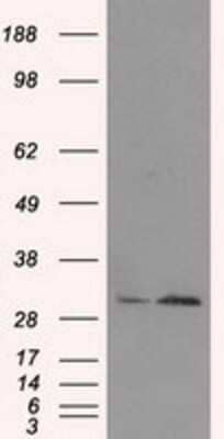 Western Blot: TIPRL Antibody (OTI3D11) [NBP2-02269]