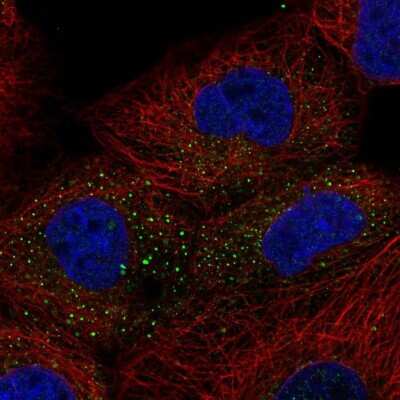 Immunocytochemistry/ Immunofluorescence: TIPRL Antibody [NBP1-85169]