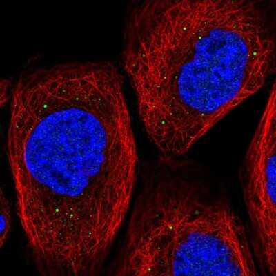 Immunocytochemistry/ Immunofluorescence: TIPRL Antibody [NBP2-55024]