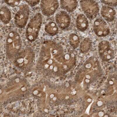 Immunohistochemistry-Paraffin: TIPRL Antibody [NBP1-85169]