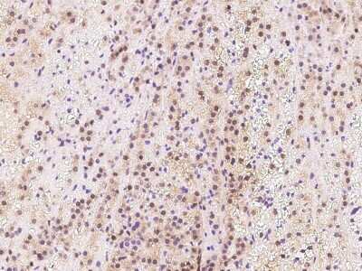 Immunohistochemistry-Paraffin: TIPRL Antibody [NBP2-98503]