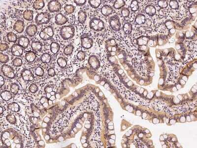 Immunohistochemistry-Paraffin: TIPRL Antibody [NBP2-98503]