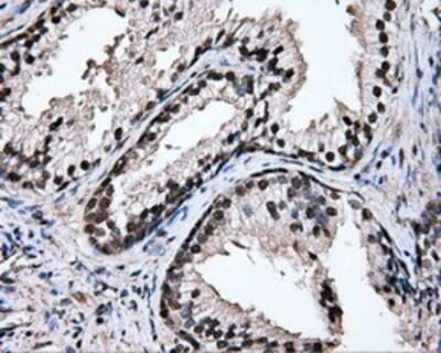 Immunohistochemistry: TIPRL Antibody (OTI3D11) - Azide and BSA Free [NBP2-74529]