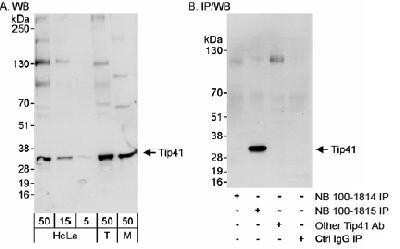 Western Blot: TIPRL Antibody [NB100-1814]