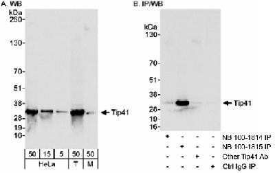 Western Blot: TIPRL Antibody [NB100-1815]