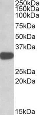 Western Blot: TIPRL Antibody [NBP1-51995]