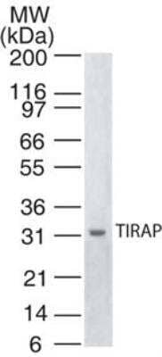 Western Blot: TIRAP Antibody (20D1055.1) [NB100-56730]